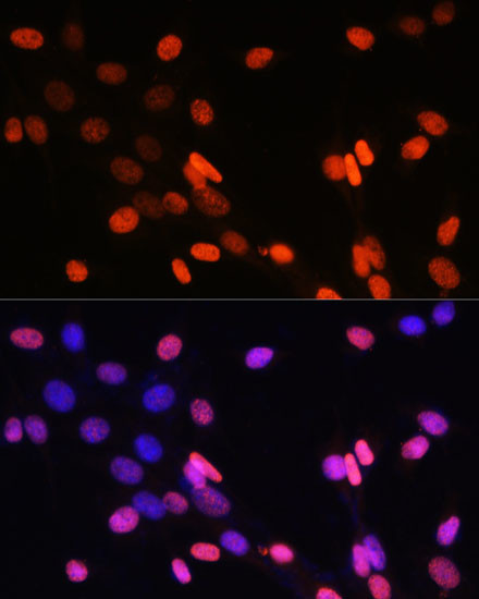 H3K14me2 Antibody in Immunocytochemistry (ICC/IF)