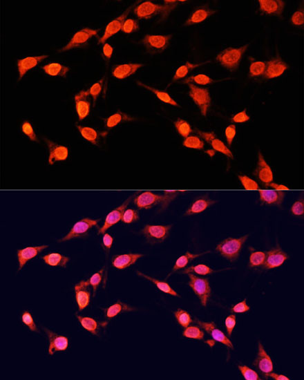 H3K14me3 Antibody in Immunocytochemistry (ICC/IF)