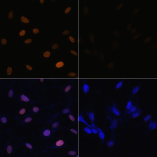 H4K16ac Antibody in Immunocytochemistry (ICC/IF)