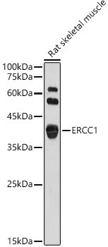 ERCC1 Antibody in Western Blot (WB)