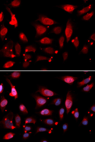 RACGAP1 Antibody in Immunocytochemistry (ICC/IF)