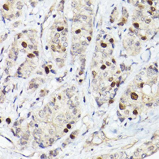 RACGAP1 Antibody in Immunohistochemistry (Paraffin) (IHC (P))