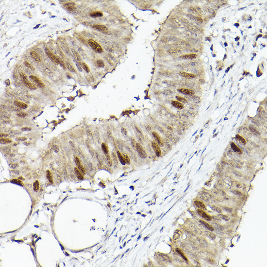 RACGAP1 Antibody in Immunohistochemistry (Paraffin) (IHC (P))