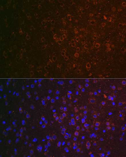 ABAT Antibody in Immunohistochemistry (Paraffin) (IHC (P))