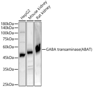 ABAT Antibody in Western Blot (WB)