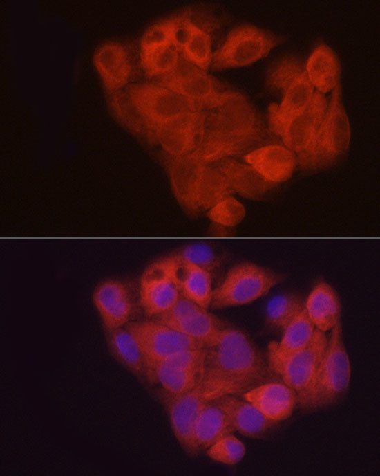 AHCY Antibody in Immunocytochemistry (ICC/IF)