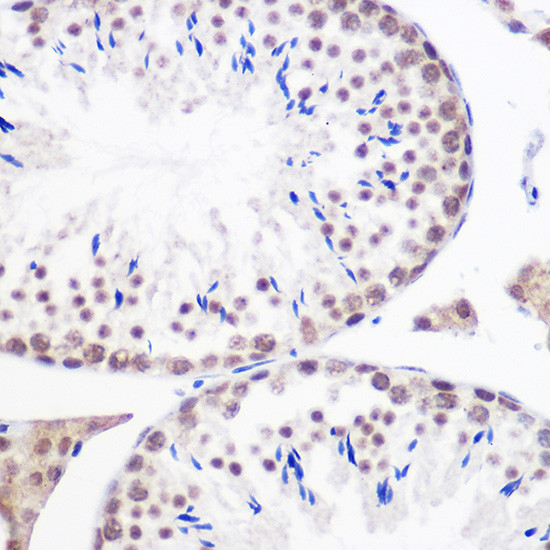 GMNN Antibody in Immunohistochemistry (Paraffin) (IHC (P))