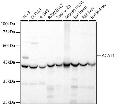 ACAT1 Antibody in Western Blot (WB)