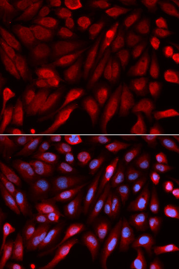 Syntenin 1 Antibody in Immunocytochemistry (ICC/IF)