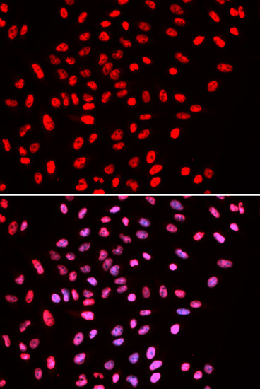 BAF57 Antibody in Immunocytochemistry (ICC/IF)