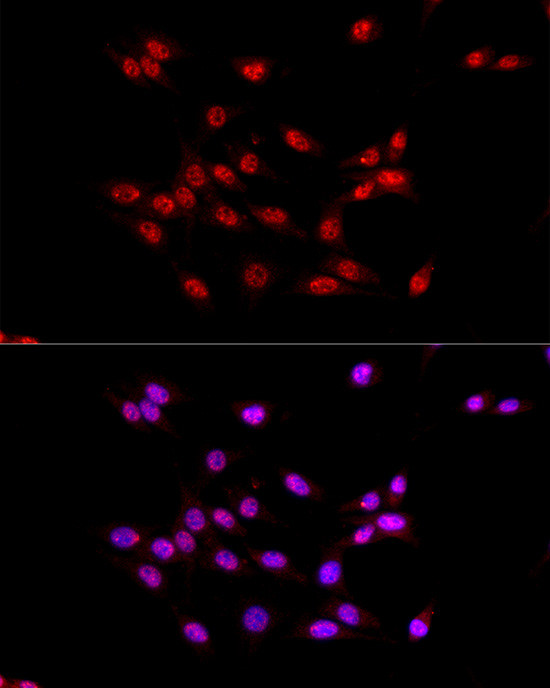 EED Antibody in Immunocytochemistry (ICC/IF)