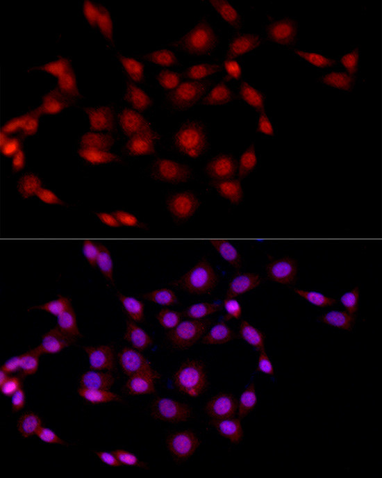 EED Antibody in Immunocytochemistry (ICC/IF)