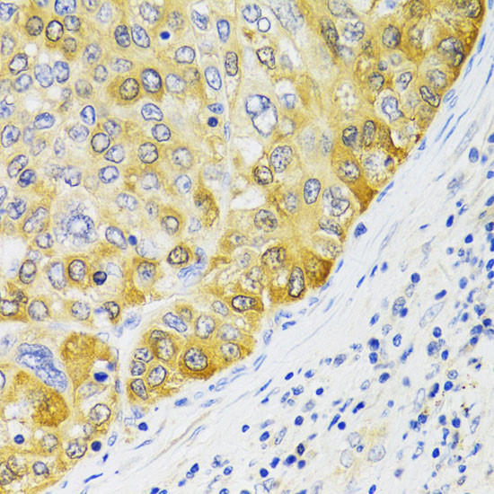 EBP1 Antibody in Immunohistochemistry (Paraffin) (IHC (P))