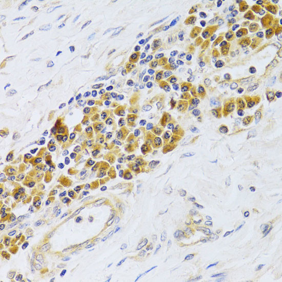 EBP1 Antibody in Immunohistochemistry (Paraffin) (IHC (P))