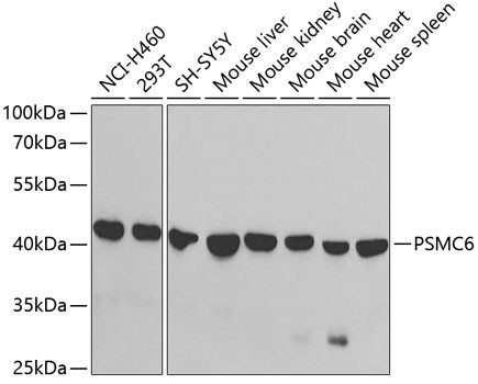 PSMC6 Antibody in Western Blot (WB)