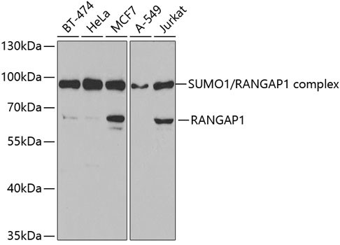 RANGAP1 Antibody in Western Blot (WB)