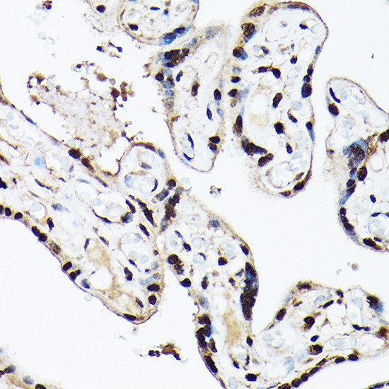 BAF53A Antibody in Immunohistochemistry (Paraffin) (IHC (P))