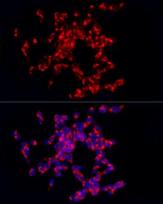 CARTPT Antibody in Immunocytochemistry (ICC/IF)