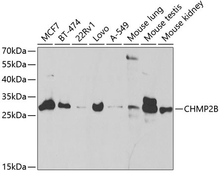 CHMP2B Antibody in Western Blot (WB)