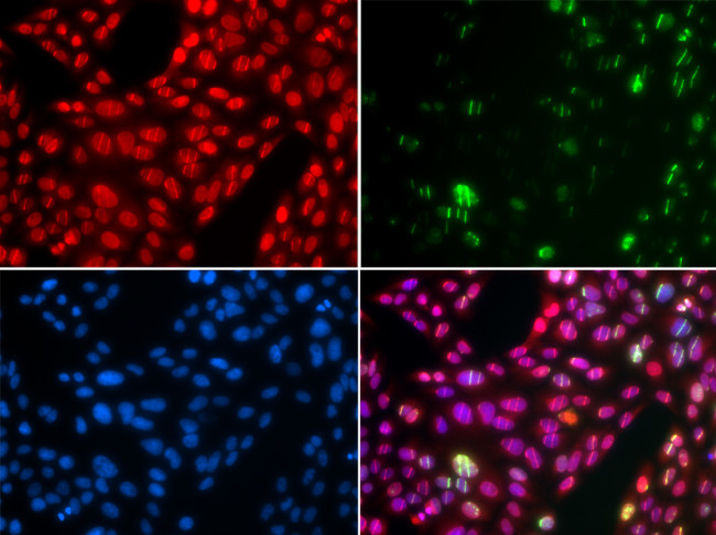 Cullin 4B Antibody in Immunocytochemistry (ICC/IF)