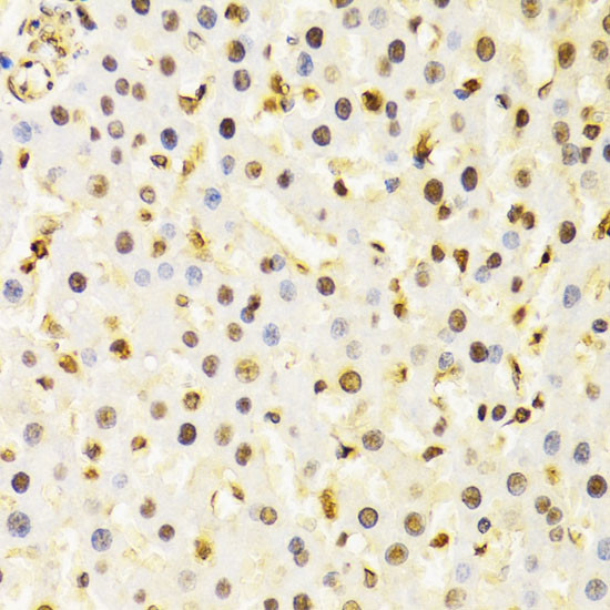 Cullin 4B Antibody in Immunohistochemistry (Paraffin) (IHC (P))