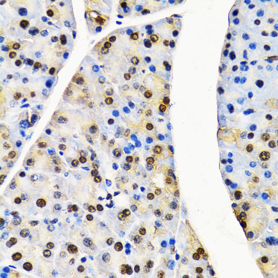 Cullin 4B Antibody in Immunohistochemistry (Paraffin) (IHC (P))