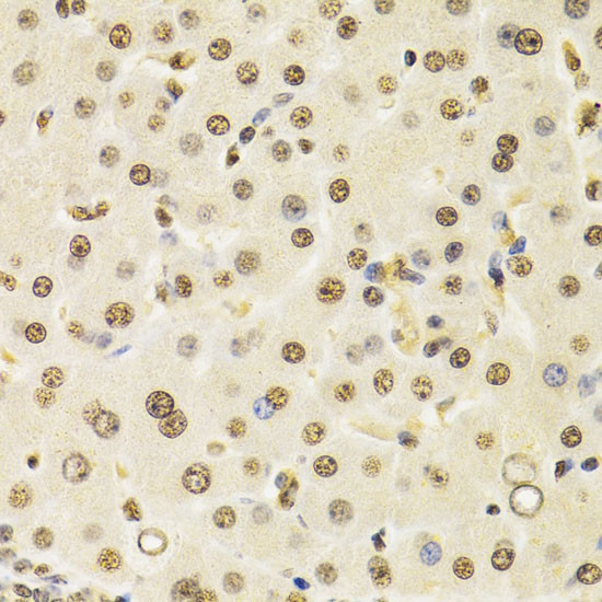 Cullin 4B Antibody in Immunohistochemistry (Paraffin) (IHC (P))