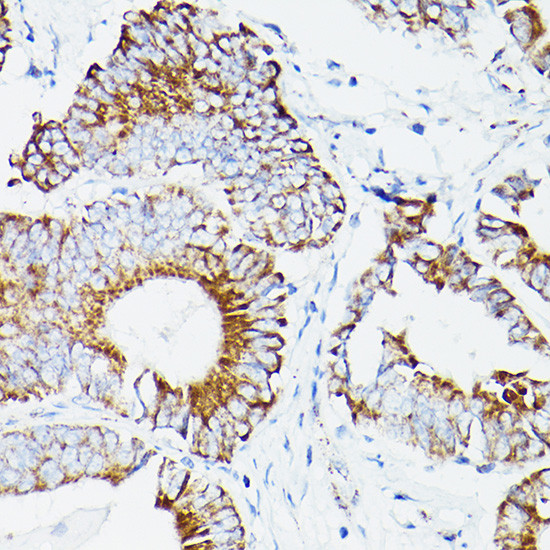 DLD Antibody in Immunohistochemistry (Paraffin) (IHC (P))