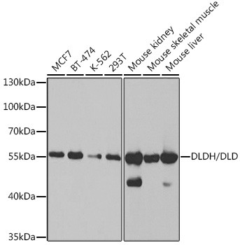 DLD Antibody in Western Blot (WB)