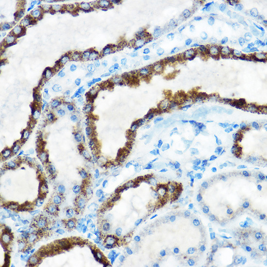 OAT Antibody in Immunohistochemistry (Paraffin) (IHC (P))