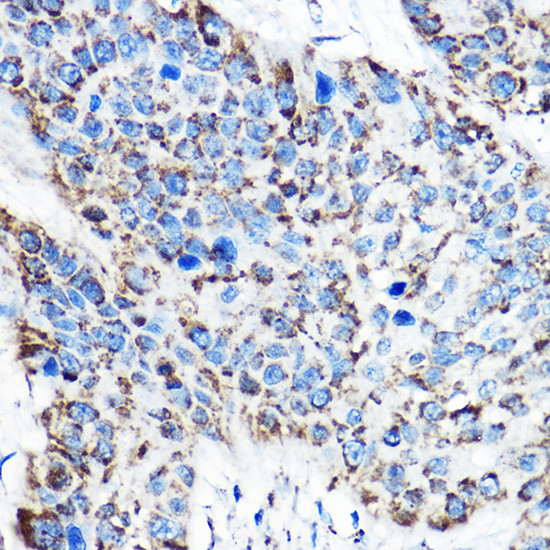 OAT Antibody in Immunohistochemistry (Paraffin) (IHC (P))