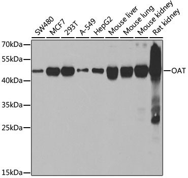 OAT Antibody in Western Blot (WB)