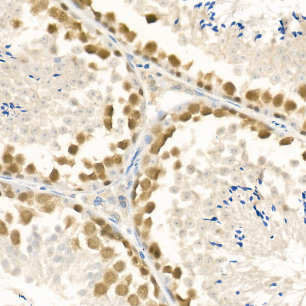 RAD51 Antibody in Immunohistochemistry (Paraffin) (IHC (P))