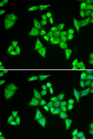 ADSL Antibody in Immunocytochemistry (ICC/IF)