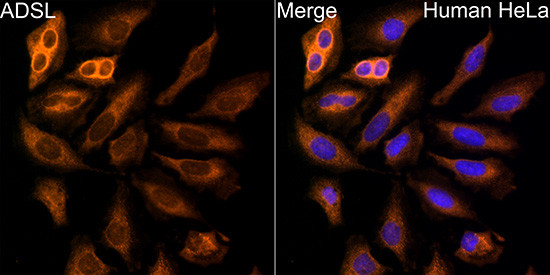 ADSL Antibody in Immunocytochemistry (ICC/IF)