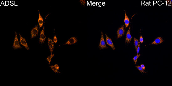 ADSL Antibody in Immunocytochemistry (ICC/IF)