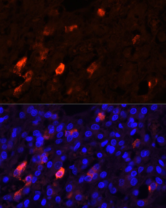 PENK Antibody in Immunocytochemistry (ICC/IF)