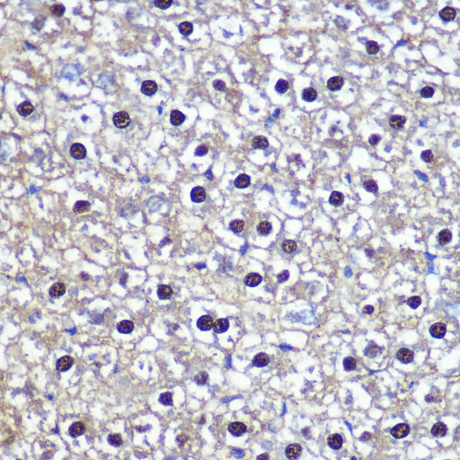 Transketolase Antibody in Immunohistochemistry (Paraffin) (IHC (P))