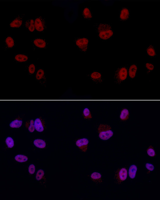 GAS41 Antibody in Immunocytochemistry (ICC/IF)