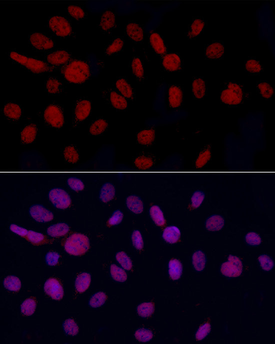 GAS41 Antibody in Immunocytochemistry (ICC/IF)