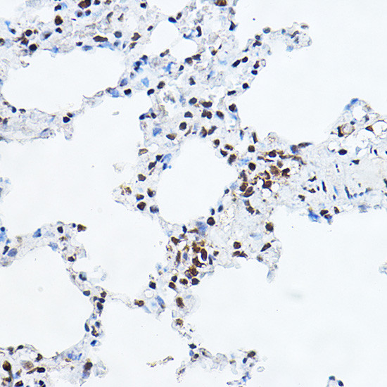 GAS41 Antibody in Immunohistochemistry (Paraffin) (IHC (P))