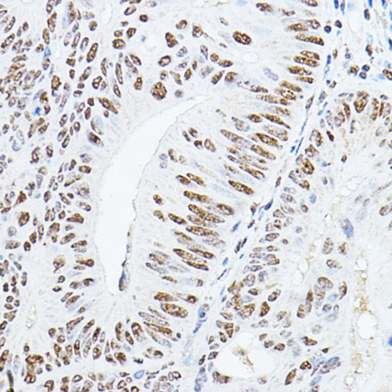 GAS41 Antibody in Immunohistochemistry (Paraffin) (IHC (P))