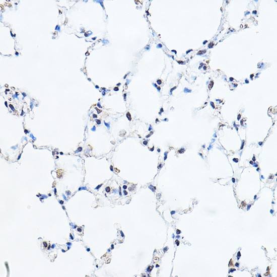 GAS41 Antibody in Immunohistochemistry (Paraffin) (IHC (P))