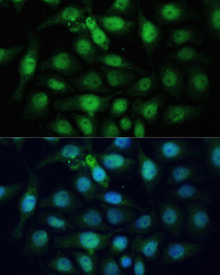 ZWINT Antibody in Immunocytochemistry (ICC/IF)