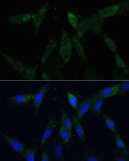 ZWINT Antibody in Immunocytochemistry (ICC/IF)