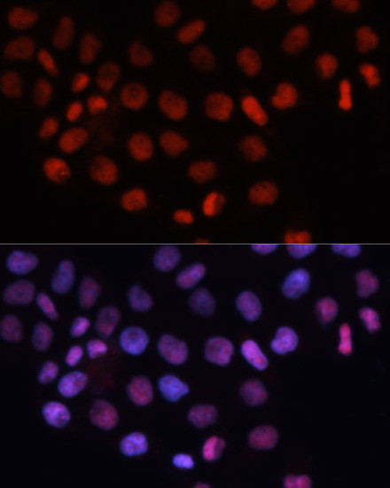 RCC1 Antibody in Immunocytochemistry (ICC/IF)