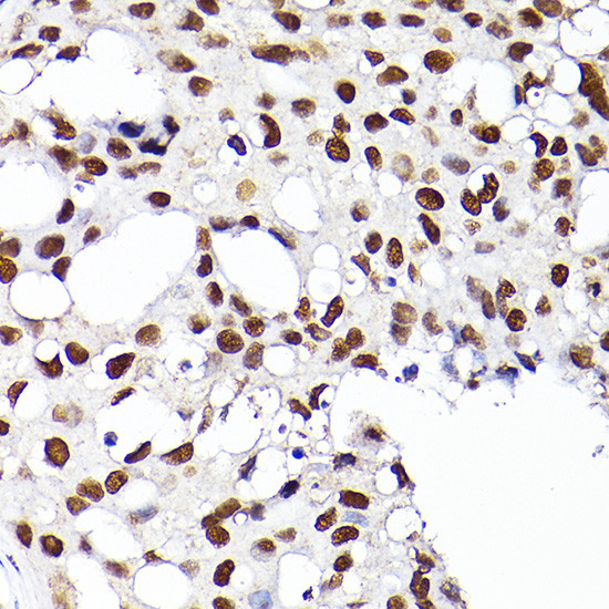 RCC1 Antibody in Immunohistochemistry (Paraffin) (IHC (P))