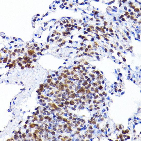 RCC1 Antibody in Immunohistochemistry (Paraffin) (IHC (P))