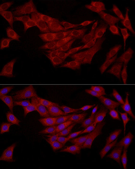 FABP5 Antibody in Immunocytochemistry (ICC/IF)