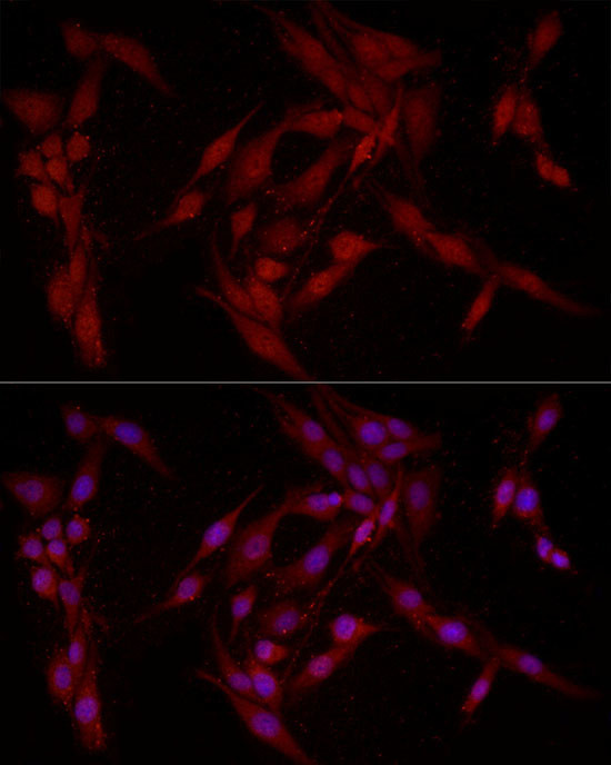 FABP5 Antibody in Immunocytochemistry (ICC/IF)